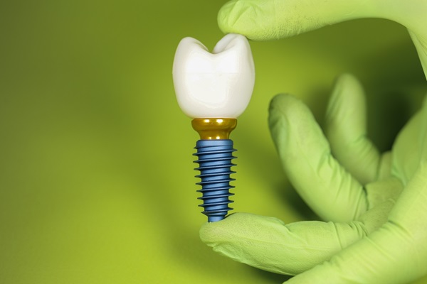 What To Consider When Choosing An Implant Restoration