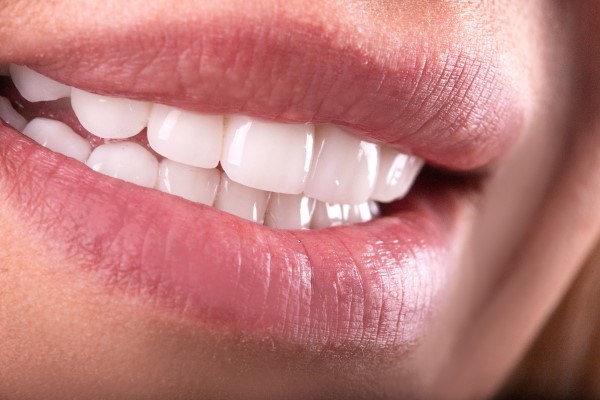 Four Tips For Preparing For A Dental Veneers Procedure