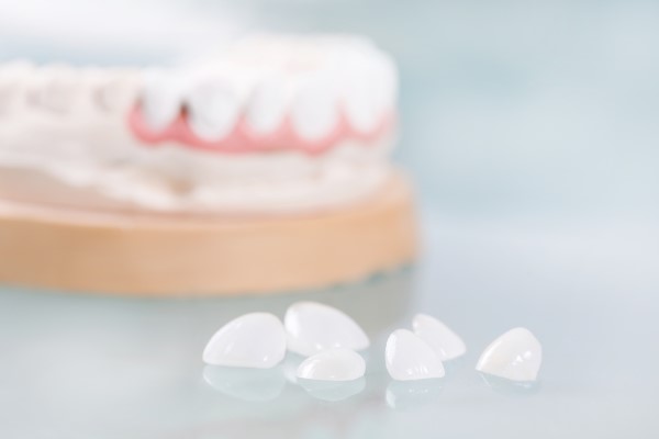 How To Prevent Stains On Dental Veneers