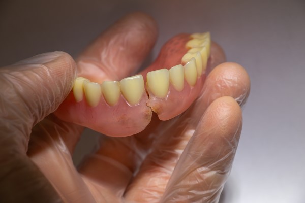 Who To Go To For Denture Repair