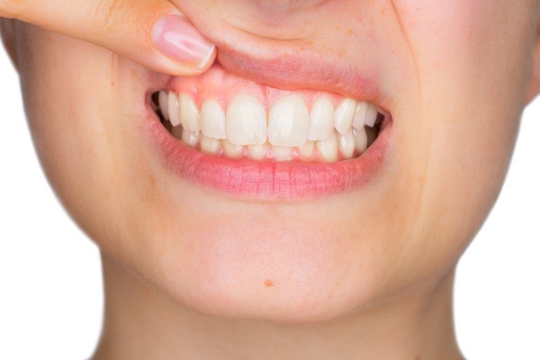 How Gum Disease Can Also Affect Your Teeth