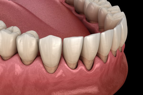 Is Gum Disease Preventable?