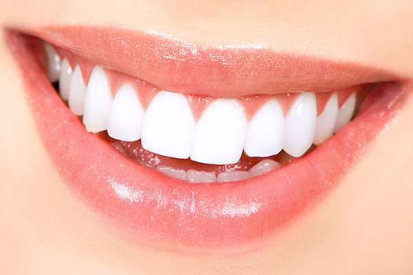 How Long Does Teeth Whitening Take from My Saratoga Dentist PLLC in Saratoga Springs, NY