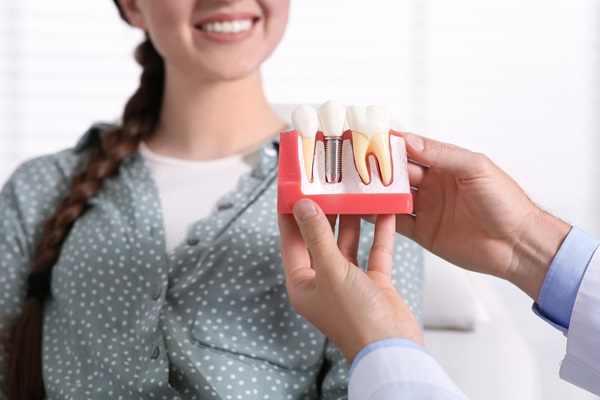 An Implant Dentist Discusses The Role Of The Jawbone With Implants