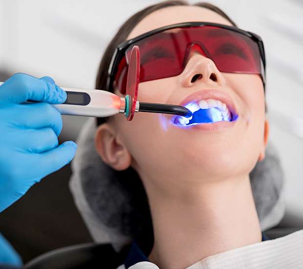 Saratoga Springs Professional Teeth Whitening