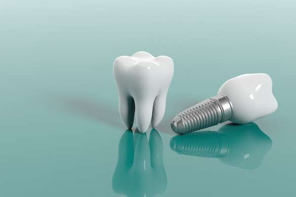Questions to Ask Your Implant Dentist from My Saratoga Dentist PLLC in Saratoga Springs, NY