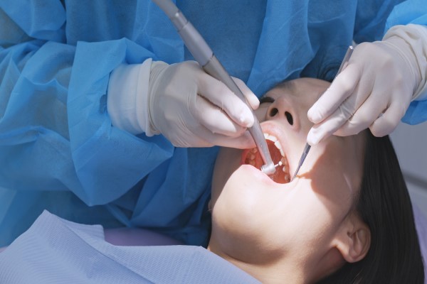 Cavity Prevention With A Routine Dental Exam