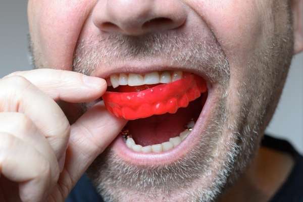 Save Your Teeth by Wearing Mouth Guards at Night from My Saratoga Dentist PLLC in Saratoga Springs, NY