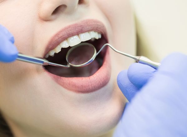 Should I Have Amalgam Dental Fillings Removed?