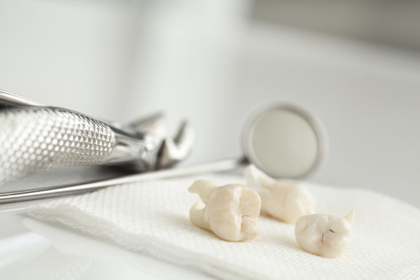 When To Have Wisdom Tooth Removal